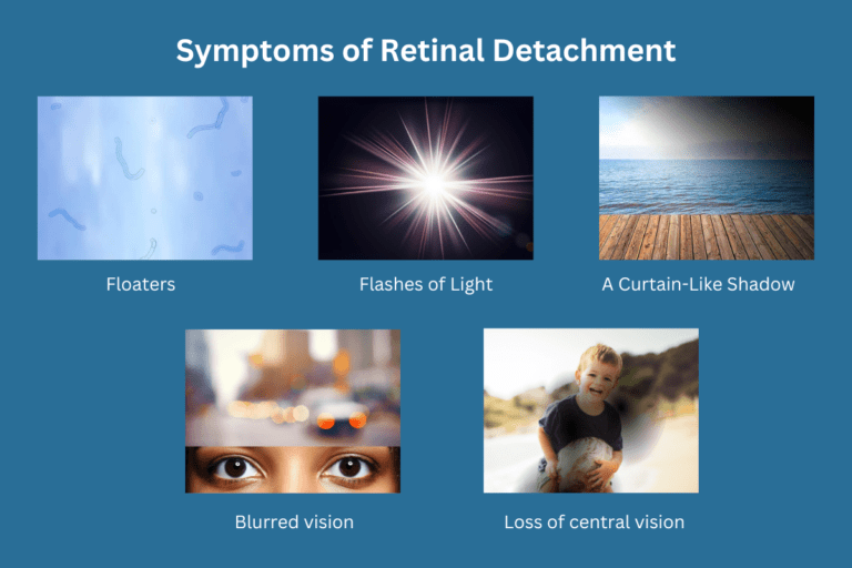 Detached Retina Symptoms: Complete Guide to Early Warning Signs